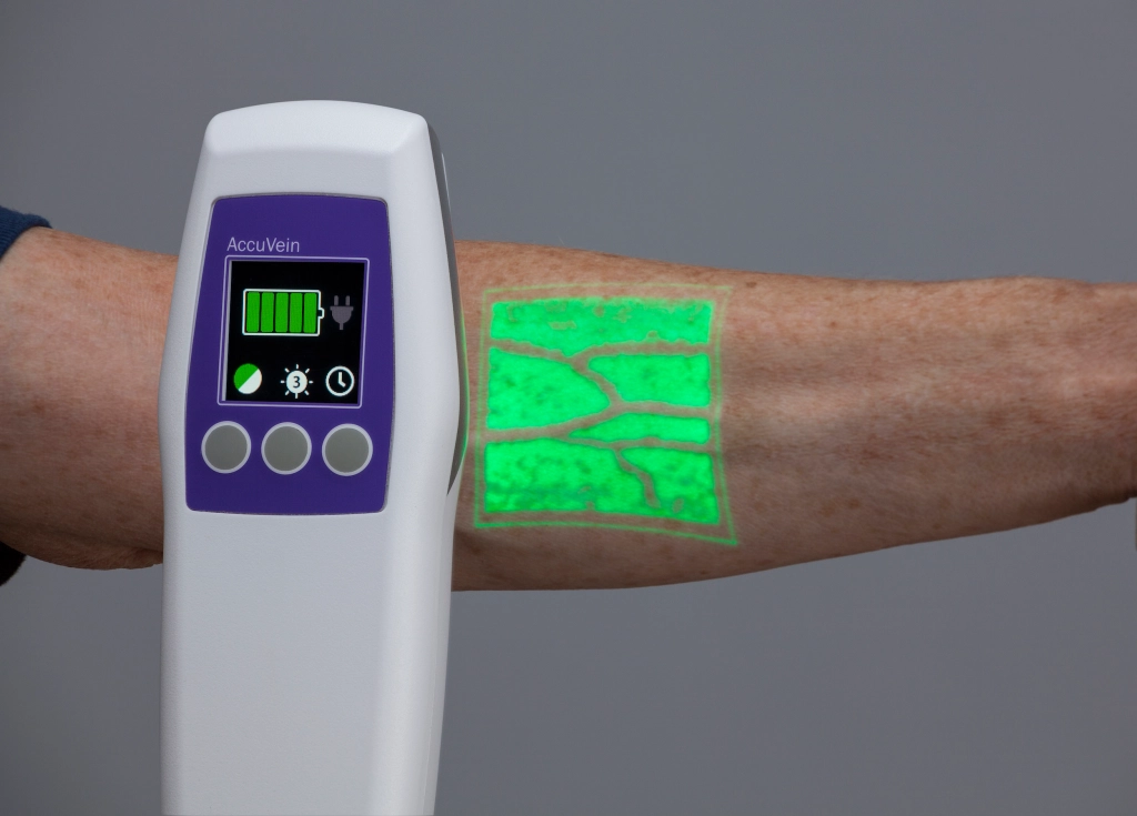 Technological Advancements Driving the Global Vein Illumination Device Market