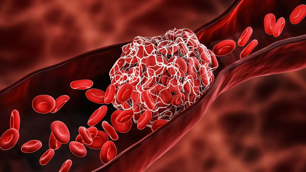 Key Factors Driving Growth in the Mechanical Thrombectomy Devices Market